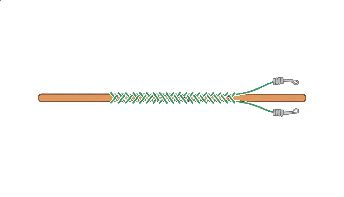 FG-Knoten